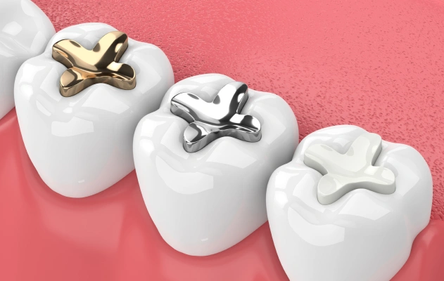 Repair and Protect Your Teeth With Seamless Fillings